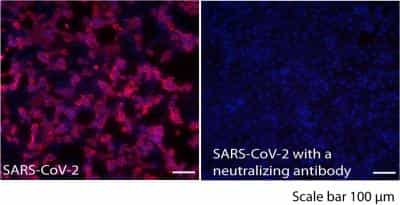 大多数人天生就可以抵抗SARS-CoV-2 1 大多数人天生就可以抵抗SARS-CoV-2