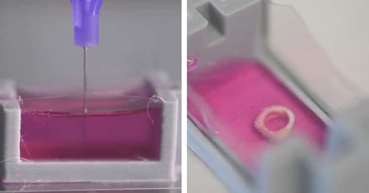 研究人员可能会很快将3D打印骨骼直接植入人体 1 研究人员可能会很快将3D打印骨骼直接植入人体