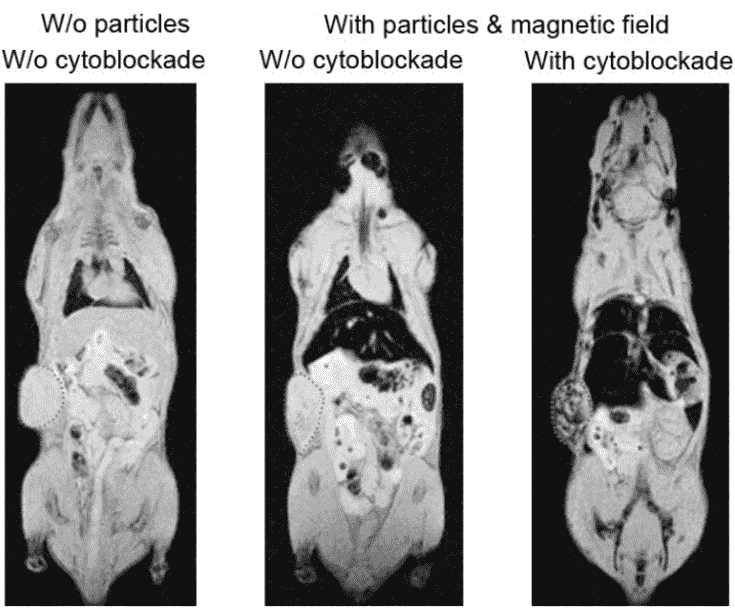 俄罗斯科学家开发出一种突破性技术有望给纳米医学带来革命性变化 2 使用细胞阻断技术(右)和不使用细胞阻断技术(中)比较将磁性纳米颗粒递送到小鼠的黑色素瘤中的情况;左侧显示了未处理的案例以供参考。
肿瘤用红色虚线圈出,深色阴影表示肿瘤中治疗性纳米颗粒的浓度更高